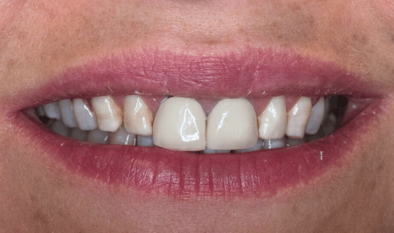 Before - Rowtree Dental Care