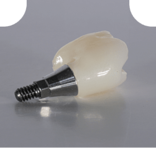  Dental Implant Rowtree Dental Care